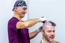 Affordable Excellence: Haartransplantation Türkei Kosten Explained